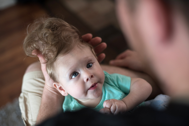 Tufts of golden curls began to grow on Bentley’s head—and his brain pouch. (Image: Katherine C. Cohen/Boston Children’s Hospital)